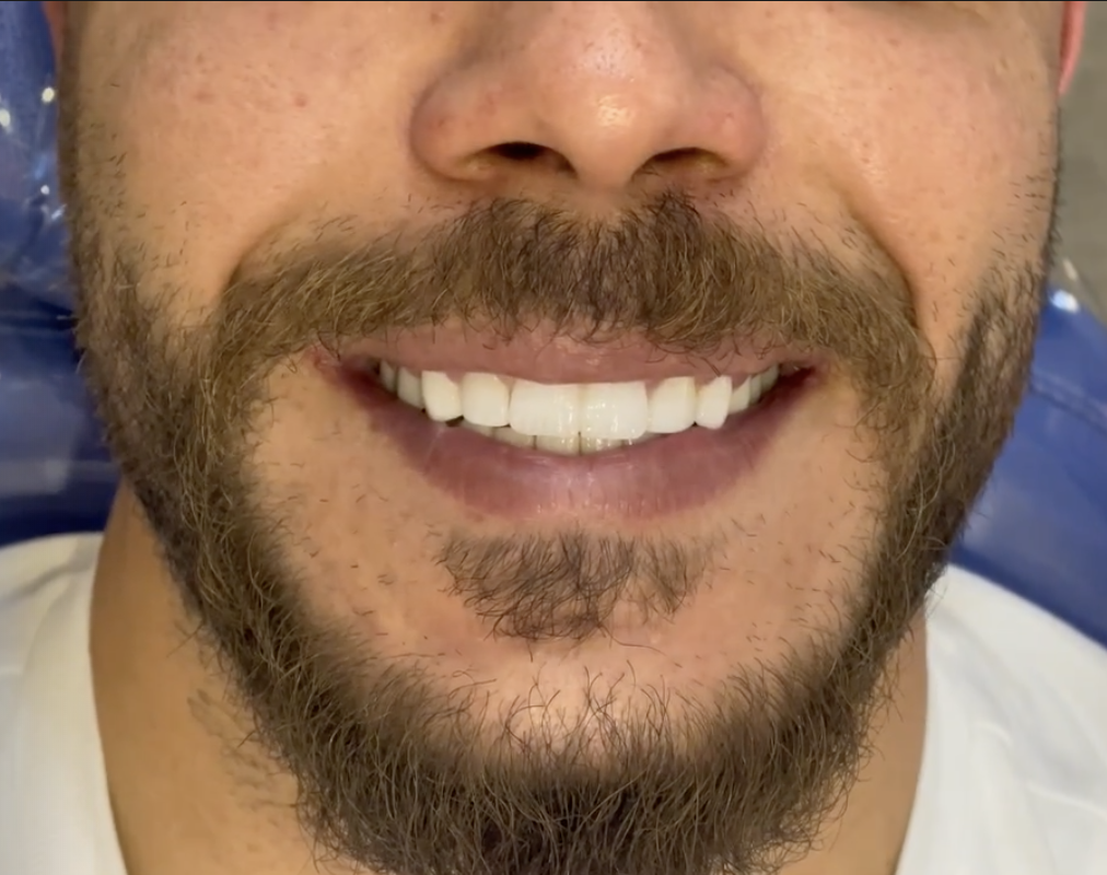 بعد